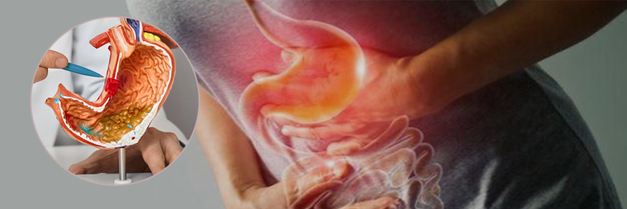 Gastrointestinal Cancer Surgery
