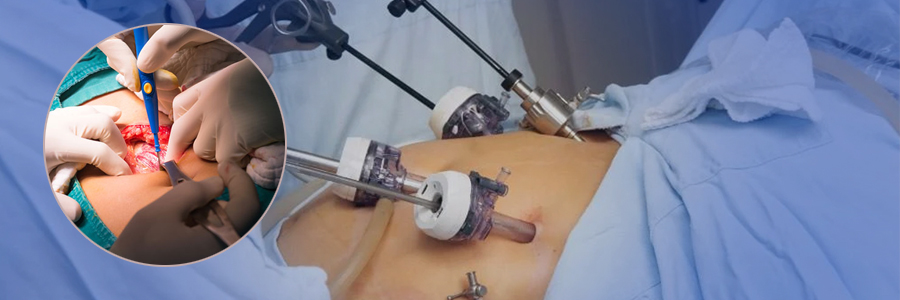 Gastrointestinal Surgery